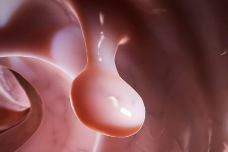 Полип мочевого пузыря лечение гомеопатией thumbnail